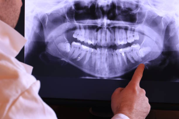 Best Emergency Treatment for Dental Infections or Abscesses in Franklin Furnace, OH