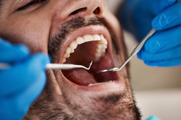 Best Same-Day Emergency Dental Services in Franklin Furnace, OH